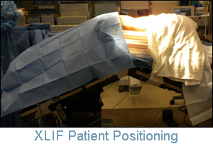 XLIF Positioning